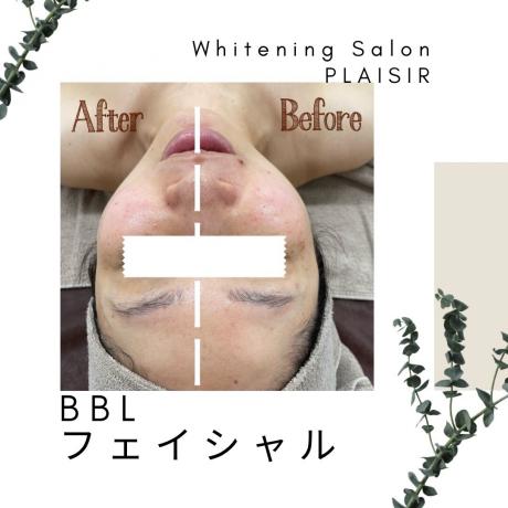 Whitening Salon PLAISIR